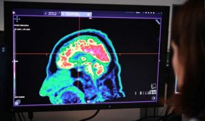 Los grandes Misterios del cerebro Imagen Cortesia ©Getty Images