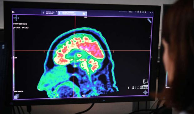 Los grandes Misterios del cerebro Imagen Cortesia ©Getty Images
